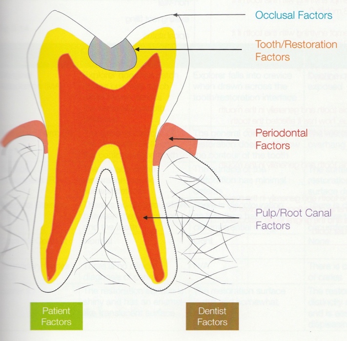 occlusal-factors